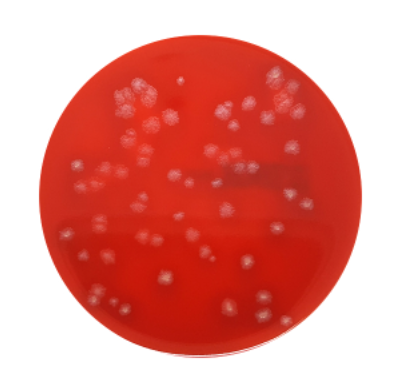 Staph/Strep Agar (CNA) Plates